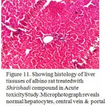 Figure 11. Showing histology of liver tissuses of albino rat treatedwith Shirishadi compound in Acute toxicityStudy.Microphotograph reveals normal hepatocytes, central vein & portal tract (40x).