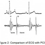 Figure 2: Comparison of ECG with PCG