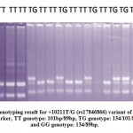 Figure 2: Genotyping result for +10211T/G (rs17846866) variant of ADIPOQ. M: Marker, TT genotype: 101bp/89bp, TG genotype: 134/101/89bp, and GG genotype: 134/89bp.