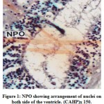 Figure 1: NPO showing arrangement of nuclei on both side of the ventricle. (CAHP)x 150.