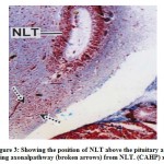 Figure 3: Showing the position of NLT above the pituitary and showing axonalpathway (broken arrows) from NLT. (CAHP) x 100.