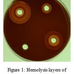 Figure 1: Hemolysis layers of Staphylococcus aureus.
