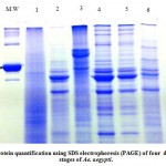 Figure 1: Protein quantification using SDS electrophoresis (PAGE) of four  development stages of Ae. aegypti.