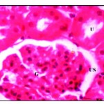 Figure 1:  Normal renal tissues showing normal uriniferous tubules (U) and glomeruli (G) with urinary space (US) X 750.