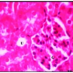 Figure 2: Renal tissues after one week of iron supplementation showing small uriniferous tubule (U) and small glomeruli (G) X750.