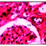 Figure 6: After three weeks of well fed with iron supplementation. Dialted renal tubules with flattened epithelial lining (U) and dilated urinary space (US) X 750.