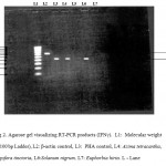 Figure 2: RT-PCR for induction of cytokines IFN-γ.