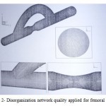 Figure 2- Disorganization network quality applied for femoral bypass