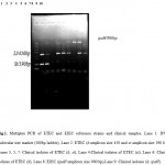 Fig.1. Multiplex PCR of ETEC and EIEC reference strains and clinical samples. Lane 1: DNA molecular size marker (100bp ladder), Lane 2: ETEC (lt amplicon size 450 and st amplicon size 190 bp), Lanes 3, 5, 7: Clinical isolates of ETEC (lt, st), Lane 4:Clinical isolates of ETEC (st), Lane 6: Clinical isolates of ETEC (lt), Lane 8: EIEC (ipaH amplicon size 900 bp),Lane 9: Clinical isolates (lt, ipaH).