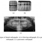 Fig 1: Three types of dental radiographs. (a) A bitewing radiograph; (b) a periapical radiograph; (c) a panoramic radiograph