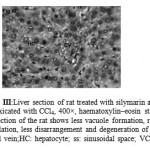 Figure 3: Liver section of rat treated with silymarin and intoxicated with CCl4, 400×, haematoxylin–eosin stain. Liver section of the rat shows less vacuole formation, reduced sinusoidal dilation, less disarrangement and degeneration of hepatocytes. CV: central vein;HC: hepatocyte; ss: sinusoidal space; VC: vacuole.
