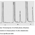 Figure 1: Chromatograms of (A) blank plasma; (B) plasma standard; (C) human plasma 2 h after administration of one ciprofloxacin tablet.