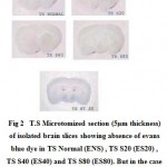 Figure 2: T.S Microtomized section (5µm thickness) of isolated brain slices showing absence of evans blue dye in TS Normal (ENS) , TS S20 (ES20) , TS S40 (ES40) and TS S80 (ES80). But in the case of TS ST 80 (EST 80) extravasation of the Evans blue dye could be clearly observed.