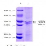 Figure 2: SDS PAGE analysis of outer membrane protein of serotype O6.