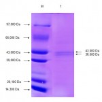 Figure 3: SDS PAGE analysis of outer membrane protein of serotype O60.