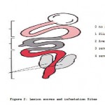 Figure 2: Lesion scores and infestation Sites.