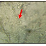 Plate 10: microscopic oocyst of E.tenella (X100).