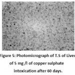 Figure 5: Photomicrograph of T.S of Liver of 5 mg /l of copper sulphate intoxication after 60 days. (Haematoxylin/Eosin) 100X, showing cytoplasmic vacuolation and focal necrotic area.