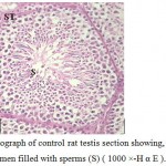 Figure 1: Light micrograph of control rat testis section showing, seminiferous tubule (ST) with central lumen filled with sperms (S) ( 1000 ×-H α E ). 