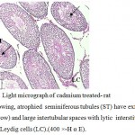 Figure 4: Light micrograph of cadmium treated- rat testis showing, atrophied seminiferous tubules (ST) have exfoliated cells (arrow) and large intertubular spaces with lytic interstitial tissue (IT) and Leydig cells (LC).(400 ×-H α E). 