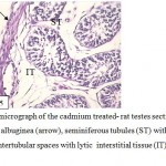 Figure 5: Light micrograph of the cadmium treated- rat testes section showing, disrupted tunica albuginea (arrow), seminiferous tubules (ST) with deformed germ cells and large intertubular spaces with lytic interstitial tissue (IT) . (400 ×-H α E ). 