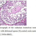 Figure 6: Light micrograph of the cadmium treated-rat testes section showing, seminiferous tubule with deformed sperm (S),central eosin material(star) and liquid infiltration (arrow). ( 1000x-H&E). 