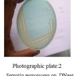 Plate:1 Serratia marcescens on DNase testDNase Test agar with toludiene blue.