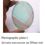Plate:2 Serratia marcescens on DNase Test agar with toludiene blue.