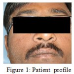 Figure 1 Patient profile.