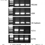 Figure 4: RT-PCR analysis of mRNA for endothelial cells. Rows demonstrated the expression of PECAM, KDR, VE cadherin, and FLT-4 gene expression compared to actin the internal control. Lane 1 –DNA ladder, Lane 2.- VEGF treated cells, Lane 3 – AEHA treated cells (2.5 mg/ml), Lane – 4. Negative control without any treatment.