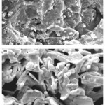 Figure 2: SEM photograph of the optimized superabsorbent hydrogel (A) Surface of porous hydrogel; (B) Cross-sectional area of porous hydrogel.