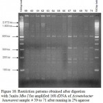 Figure 16: Restriction patterns obtained after digestion with 5units Mbo I for amplified 16S rDNA of Acinetobacter baumannii sample # 59 to 71 after running in 2% agarose gel. 100 bp ladder was used as a standard size marker.