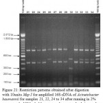 Figure 21: Restriction patterns obtained after digestion with 10units Msp I for amplified 16S rDNA of Acinetobacter baumannii for samples 21, 22, 24 to 34 after running in 2% agarose gel. 100 bp ladder was used as a standard size marker 