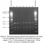 Figure 8: Restriction patterns obtained after digestion with 5units Alu I for amplified 16S rDNA of Acinetobacter baumannii sample # 72 to 78 after running in 2% agarose gel. 100 bp ladder was used as a standard size marker.