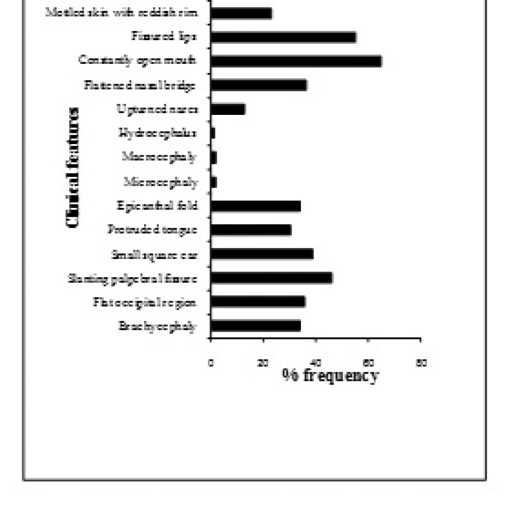Evaluation Of Dysmorphic Features In Intellectual Disability