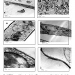 Figure 2: TEM images of thin sections of stained Pleurotus ostreatus cells (a, b & c) without Ag+ ions (as controls) and (d, e & f) after reaction with Ag+ ions for 24 h, at different magnifications (5k for a & d, 30k for b & e and 80k for c & f). Scale bars in (a & d), (b &e) and (c & f) corresponded to 2 µm, 500 nm and 100 nm, respectively.