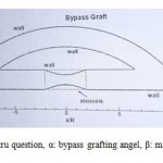 Figure 1. geometru question, α: bypass grafting angel, β: main artery angel.