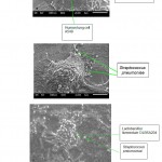 Figure 6: SEM observation on L.fermentum DLBSA204 and S.pneumoniae adherence to human lung cell. (A) A549 cells without bacteria adhesion. (B) A549 cells with adherent L.fermentum DLBSA204 for 24 hours. (C) A549 cells with adherent S.pneumoniae. (D) A549 cells incubated with L. fermentum DLBSA204 for 2 hours, followed by addition of S. pneumoniae for 24 hours. (E) A549 cells incubated with S. pneumoniae for 2 hours, then addition of L. fermentum DLBSA204 for 24 hours. Bar = 5 μm