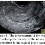 Figure 1: The measurement of the length and anteroposterior size of the uterus and endometrium in the sagittal plane scanning