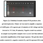 Figure (2): Ethidium bromide-stained PCR products after gel electrophoresis. Primer set was used to amplify a sequence of G6PD gene. (2% agarose gel, 10 minutes at 100 voltage and then lowered to 70 Volts, 50 minutes). Negative result was noticed in sample 4,6,10.positive samples were 1,2,3,5,7,8,9 thus indicate successful amplification of the target sequence. The gel also shows a positive control (C), negative control (N), and M represent DNA ladder.