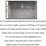 Figure 3: Ethidium bromide-stained PCR products after gel electrophoresis. Primer set was used to amplify a sequence of G6PD gene. (1.5% agarose gel, 10 minutes at 100 voltage and then lowered to 70 Volts, 1 h and 30 minutes) Negative result was noticed sample 1,2,3,4,5,7,10. Positive sample were 6,8,9, thus indicate successful amplification of the target sequence. The gel also shows a positive control (C), negative control (N), and M represent DNA ladder