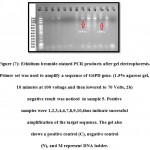 Figure 7: Ethidium bromide-stained PCR products after gel electrophoresis. Primer set was used to amplify a sequence of G6PD gene. (1.5% agarose gel, 10 minutes at 100 voltage and then lowered to 70 Volts, 2h) negative result was noticed in sample 5. Positive samples were 1,2,3,4,6,7,8,9,10,thus indicate successful amplification of the target sequence. The gel also shows a positive control (C), negative control (N), and M represent DNA ladder.