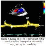Figure 4: Range of speed of movement of the anterior wall of the superior mesenteric artery during its remodeling