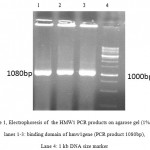 Figure 1: Electrophoresis of the HMW1 PCR products on agarose gel (1% w/v) lanes 1-3: binding domain of hmw1gene (PCR product 1080bp), Lane 4: 1 kb DNA size marker.