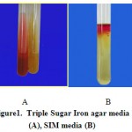 Figure 1: Triple Sugar Iron agar media (A), SIM media (B)