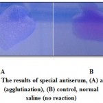 Figure 2: The results of special antiserum, (A) antiserum (agglutination), (B) control, normal saline (no reaction)