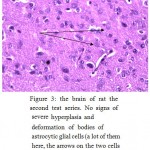 Figure 3: The brain of rat the second test series. No signs of severe hyperplasia and deformation of bodies of astrocytic glial cells (a lot of them here, the arrows on the two cells shown an example). H & E stain. Increased x160.