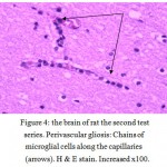 Figure 4: The brain of rat the second test series. Perivascular gliosis: Chains of microglial cells along the capillaries (arrows). H & E stain. Increased x100.