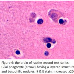 Figure 6: The brain of rat the second test series. Glial phagocyte (arrow), having a layered structure and basophilic nodules. H & E stain. Increased x200.
