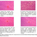 Figure 2: Effect of ethanolic extract of C. antiquorum (CA) on alcohol induced histopatological changes of hepatotoxicity in rats.